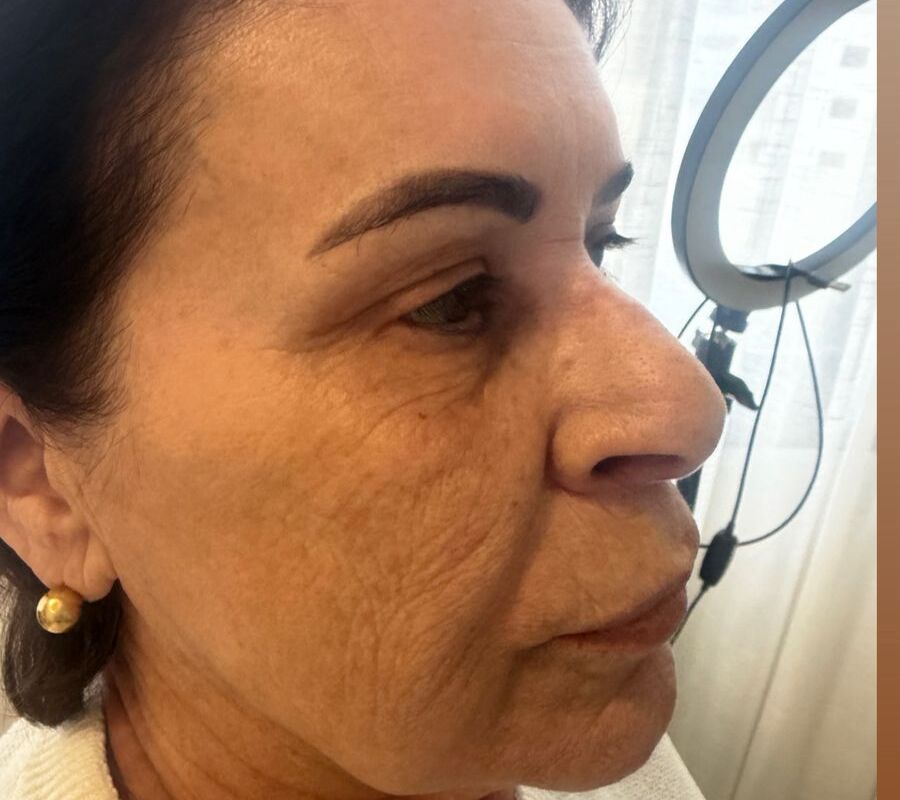 Sônia — depois do uso do Skin Pause